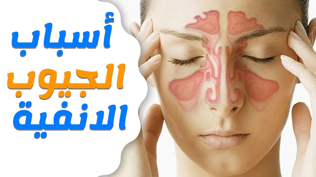 احتقان الجيوب الأنفية