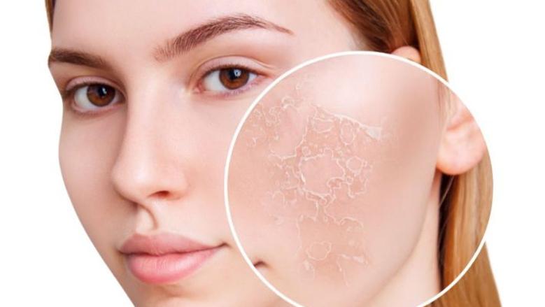 "أضرار الشتاء للبشرة".. الواقي المعدني خط الدفاع الأول