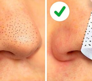 الرؤوس السوداء