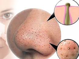 الرؤوس السوداء