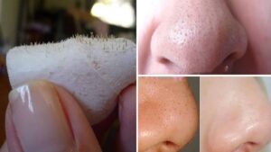 الرؤوس السوداء