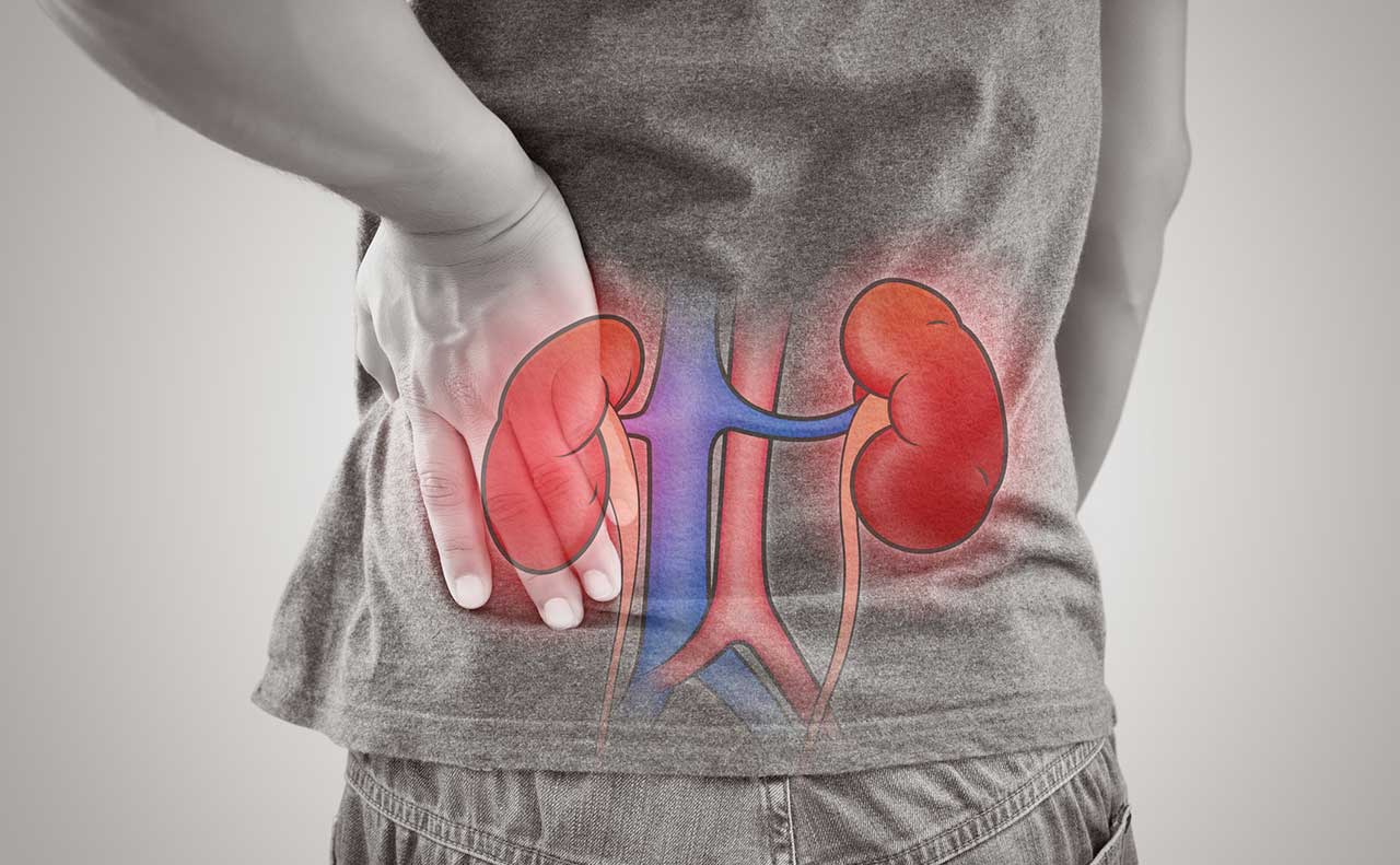 علامات تلف الكلى