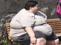 أسباب السمنة المفرطة