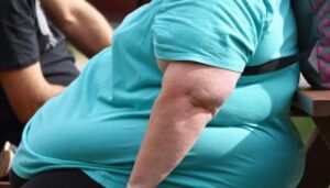 أسباب السمنة المفرطة