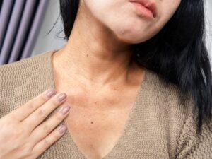 ظهور بقع داكنة على الرقبة